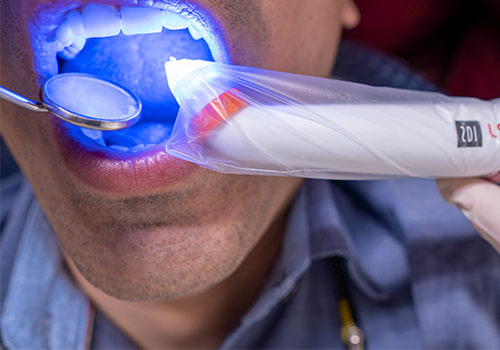 clareamento dental jundiai